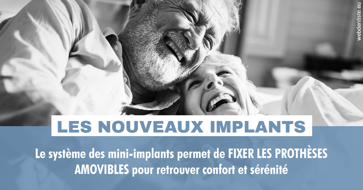 https://dr-morgane-pelletier.chirurgiens-dentistes.fr/Les nouveaux implants 2