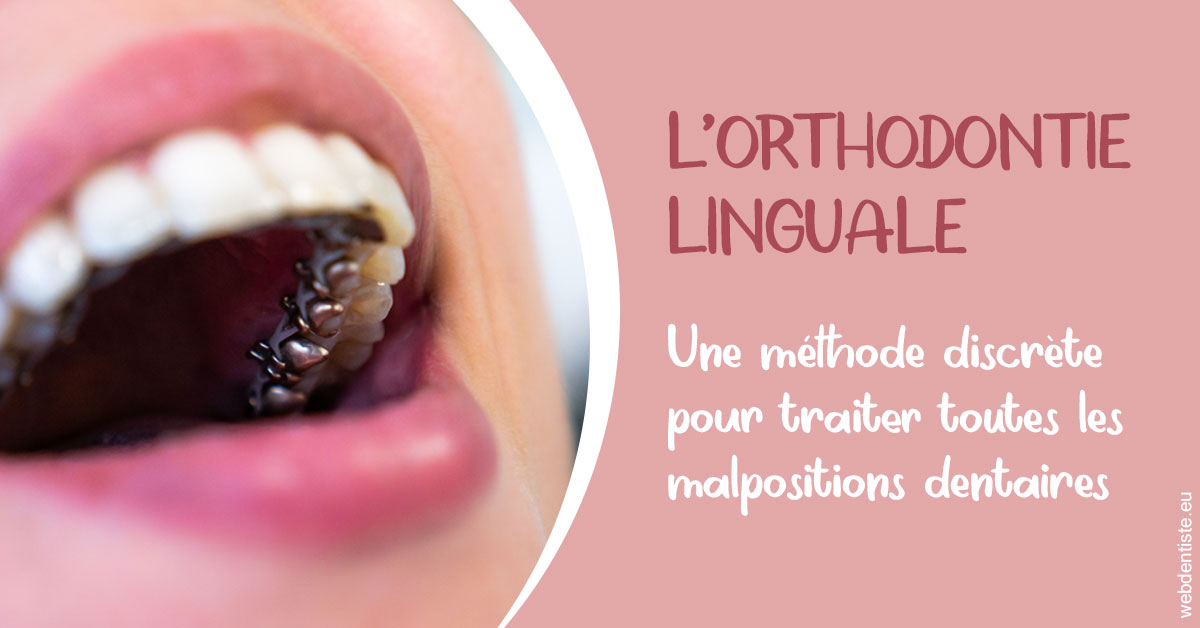 https://dr-morgane-pelletier.chirurgiens-dentistes.fr/L'orthodontie linguale 2