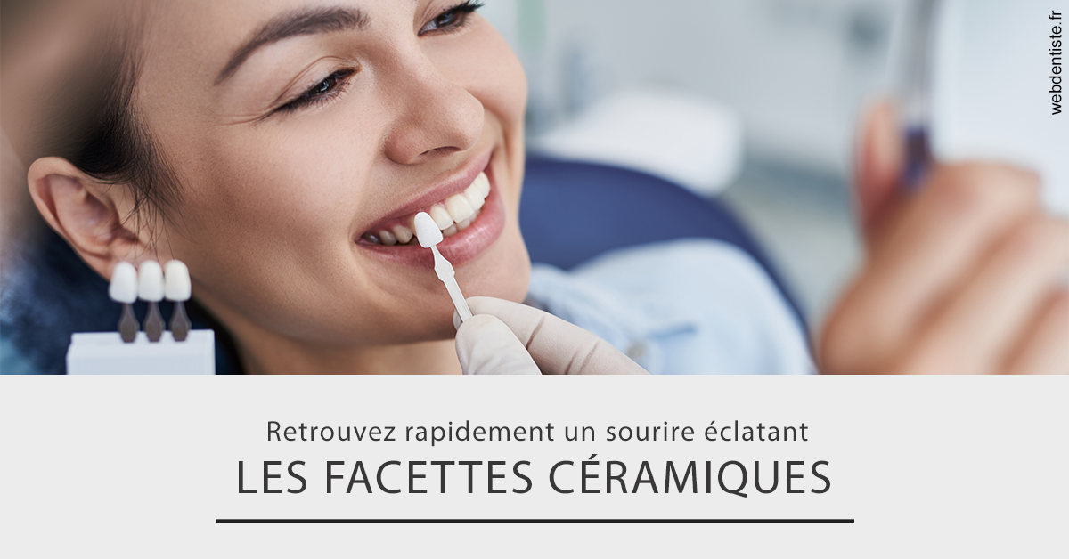 https://dr-morgane-pelletier.chirurgiens-dentistes.fr/Les facettes céramiques 2
