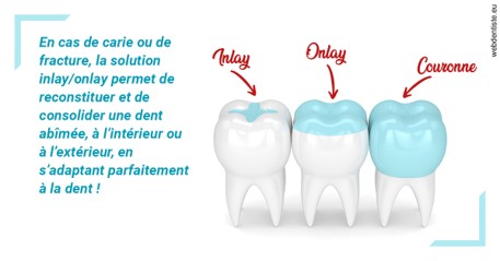 https://dr-morgane-pelletier.chirurgiens-dentistes.fr/L'INLAY ou l'ONLAY