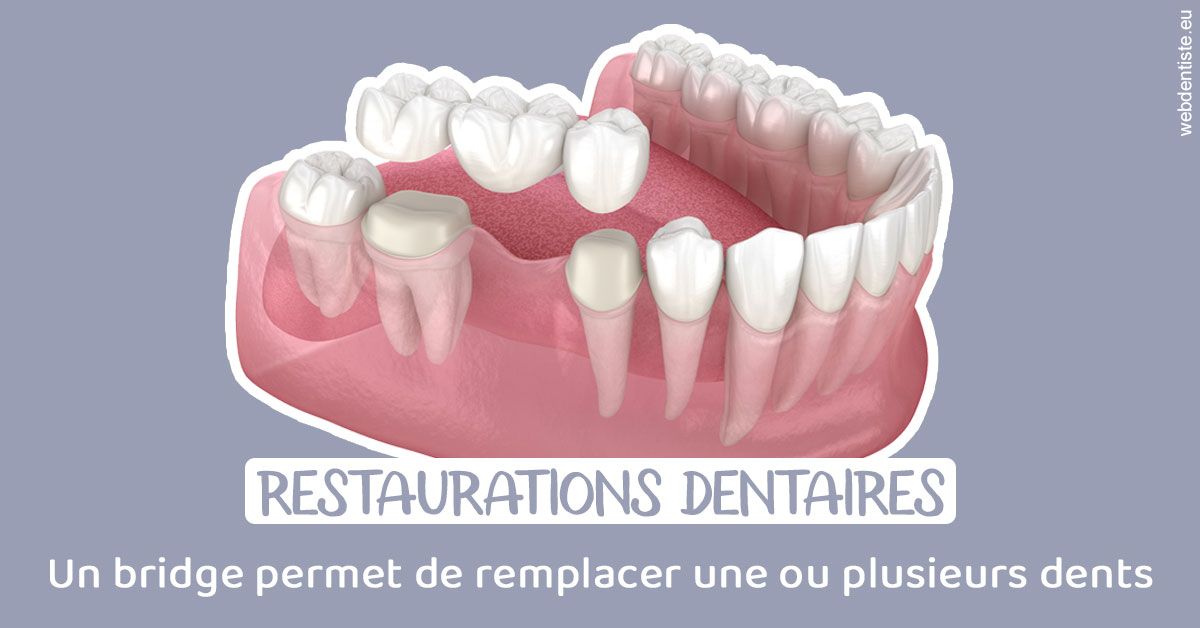 https://dr-morgane-pelletier.chirurgiens-dentistes.fr/Bridge remplacer dents 1