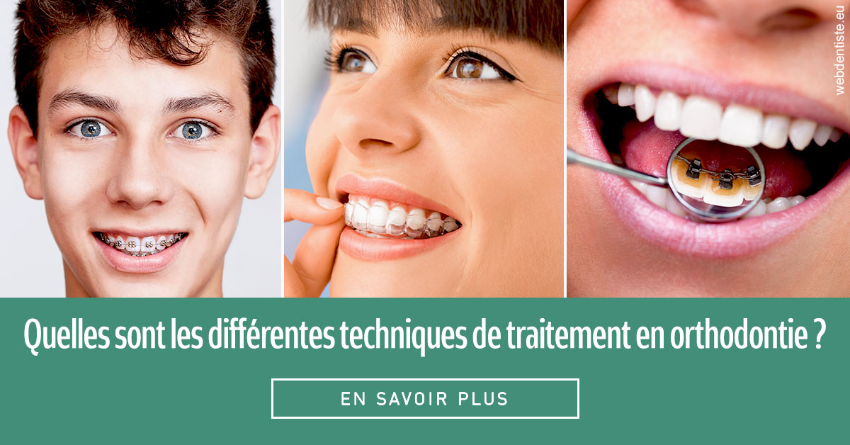https://dr-morgane-pelletier.chirurgiens-dentistes.fr/Les différentes techniques de traitement 2