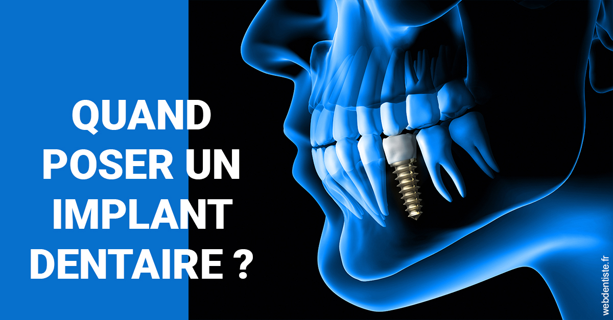 https://dr-morgane-pelletier.chirurgiens-dentistes.fr/Les implants 1