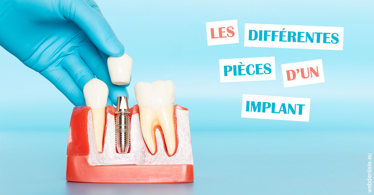 https://dr-morgane-pelletier.chirurgiens-dentistes.fr/Les différentes pièces d’un implant 2