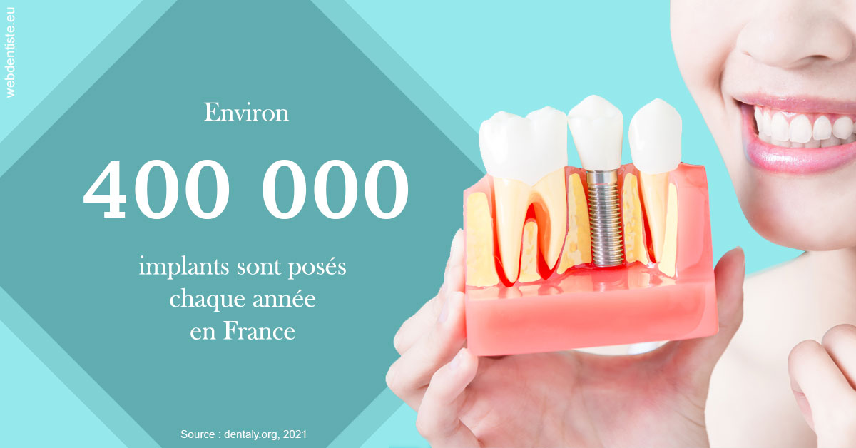 https://dr-morgane-pelletier.chirurgiens-dentistes.fr/Pose d'implants en France 2