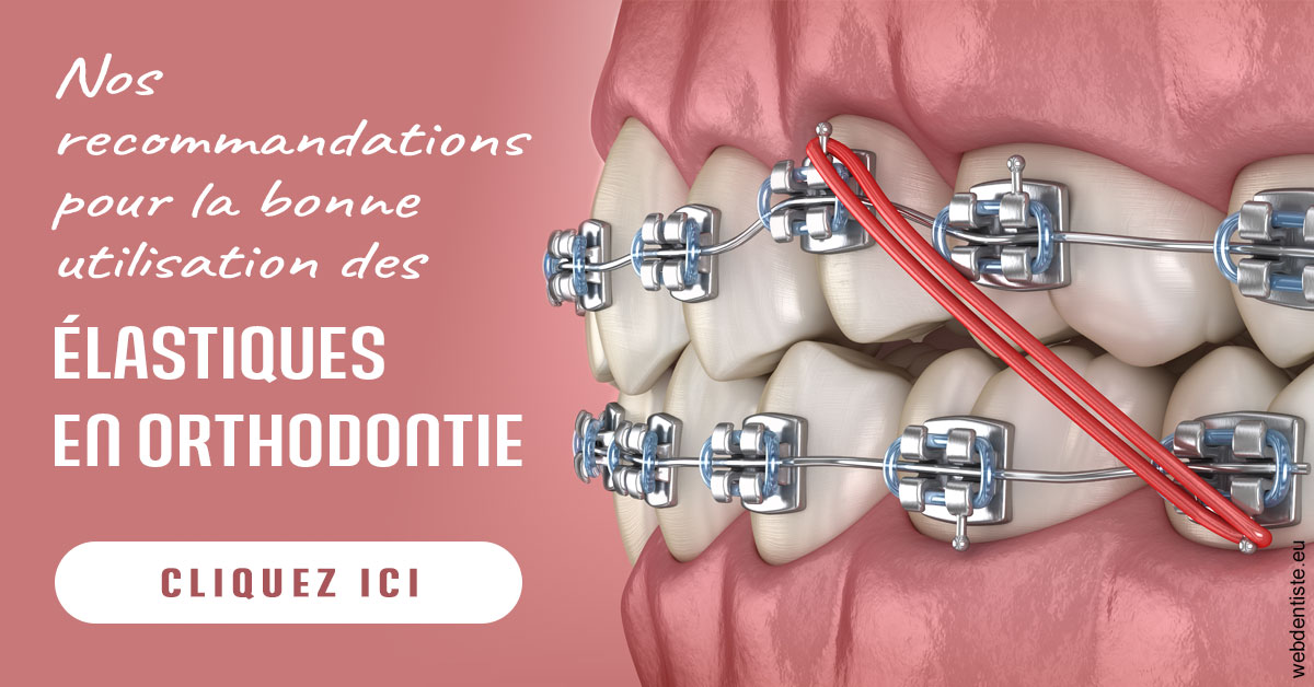 https://dr-morgane-pelletier.chirurgiens-dentistes.fr/Elastiques orthodontie 2